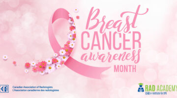 L’importance de la santé mammaire et de la sensibilisation au cancer du sein