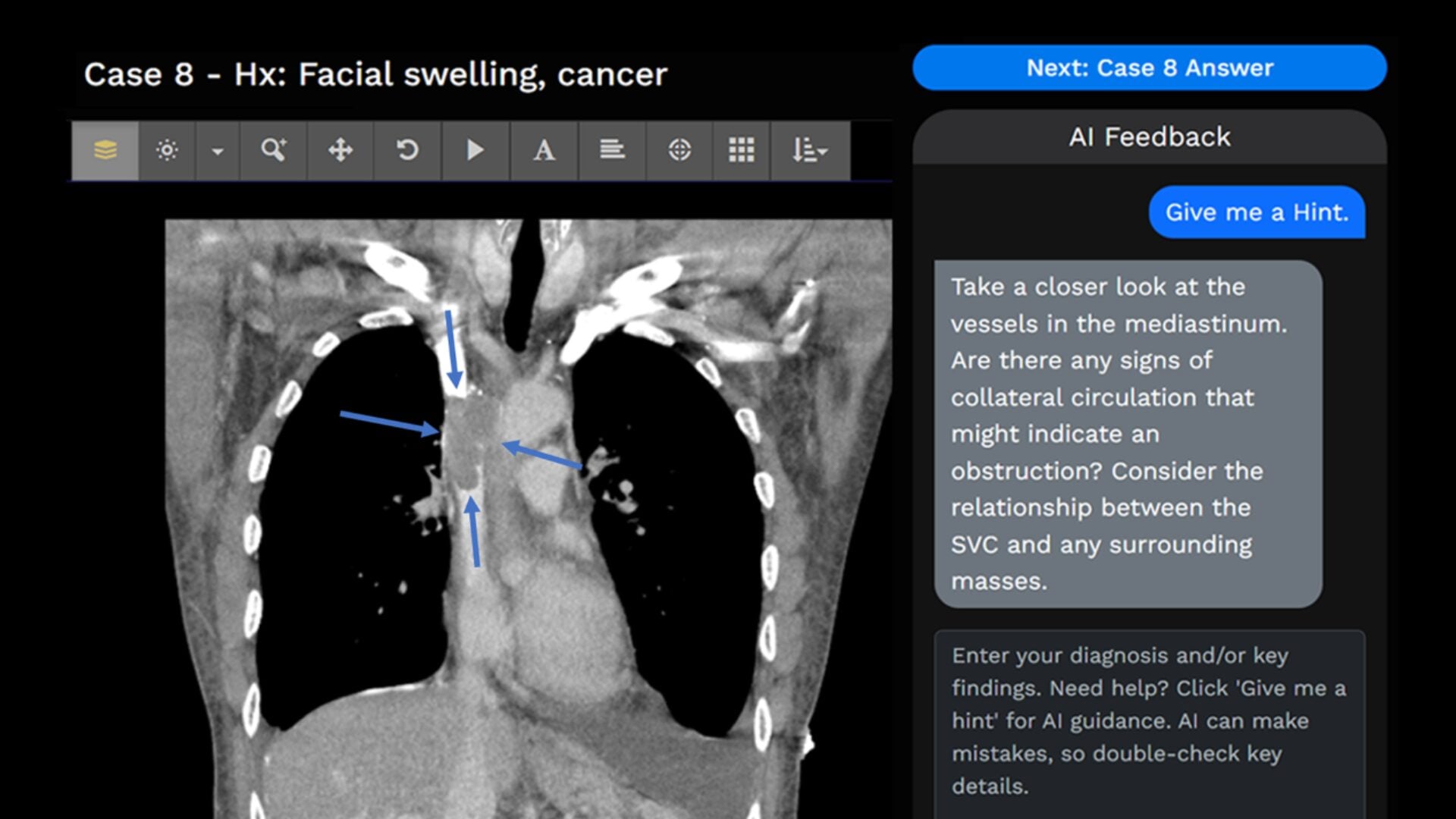 Bridging the Gap: How Navigating Radiology is Redefining Radiology ...